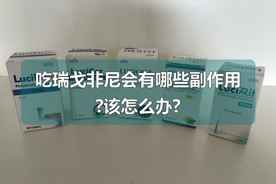 吃瑞戈非尼会有哪些副作用?该怎么办?